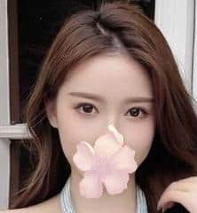 はなちゃんの画像