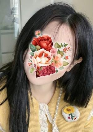 レイナ ちゃんの画像